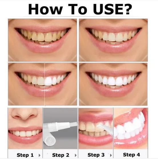 Flawless Teeth Whitening Pen