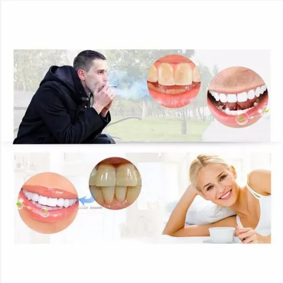 Flawless Teeth Whitening Pen